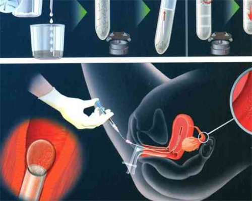 广州供卵试管代怀医院排名及费用指南